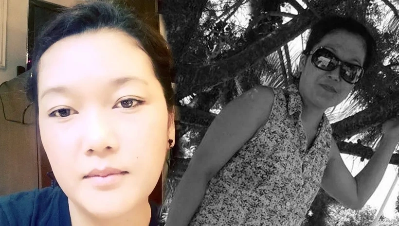 Estetik yaptıran Shatenova hayatını kaybetti