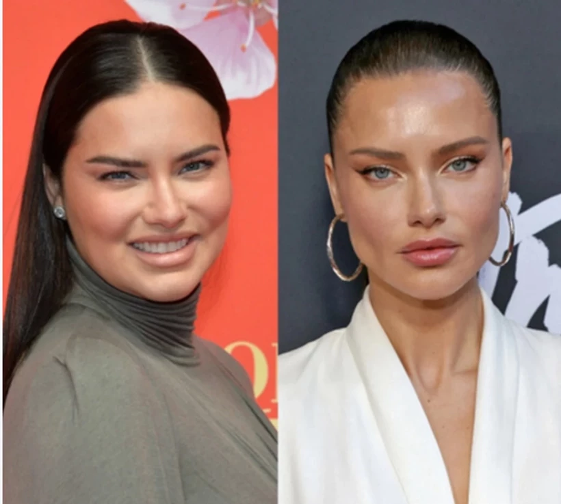 Adriana Lima'nın Son Hali Şaşırttı: Yüz Yağlarını mı Aldırdı?