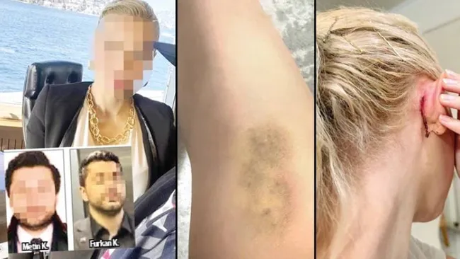 İstanbul’da Avukat Ofisinde Şiddet İddiası: Meslektaşlar Arasında Kavga Yargıya Taşındı