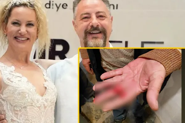 'Eşimden şiddet görüyorum' demişti: Yıldız Asyalı'dan kanlar içindeki babası için yardım çığlığı!