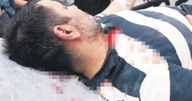 Yolsuzlukları ifşa etti kazma-kürekle dövüldü