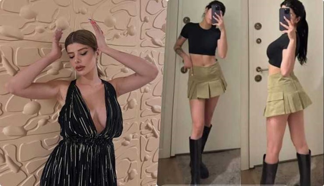 Sosyal Medya Fenomeni Merve Yalçın Süper Minisiyle Büyüledi!