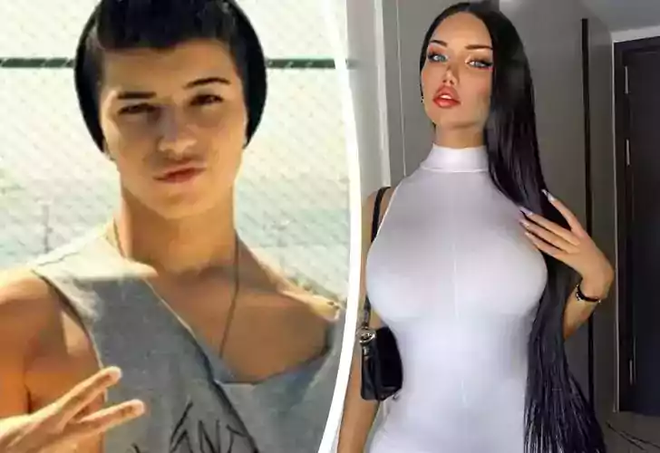 Beren Güney bir ameliyat daha oldu! Cinsiyet geçiş operasyonu sonrası belden aşağısını paylaştı