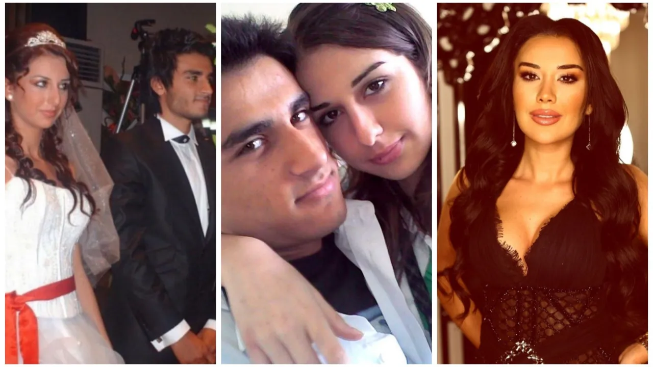 Dilan Polat'ın eltisi Hazal Erdoğan'ın estetiksiz hali şok etti!