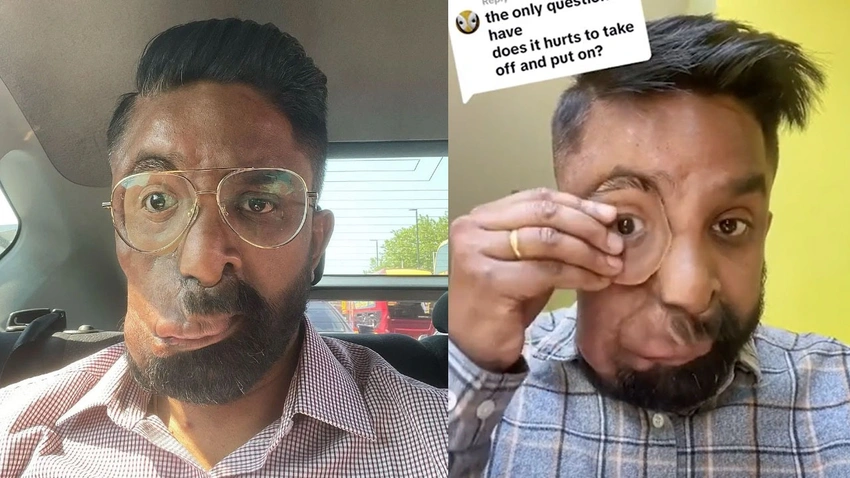 Gözünü çıkarıp taktı 5 milyona yakın izlenme aldı!