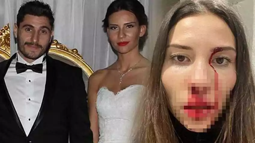 Darp davasında karar çıktı! Özer Hurmacı'ya para cezası