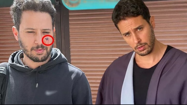 Tuan Tunalı'yı köpek ısırdı!