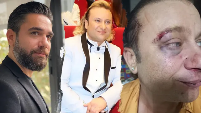 Onur Akay 'mason' demişti, saldırıya uğradı!